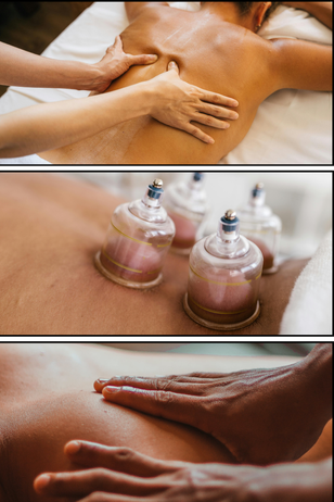 sport-cupping-masaje